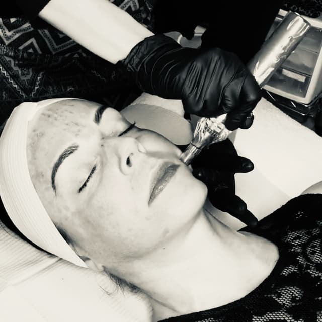 Microneedling package at The Aesthetic Skincare in Mesa, AZ